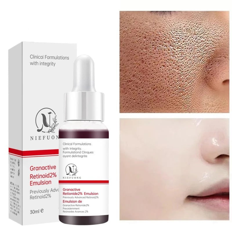 Sérum encolhedor de poros e tratamento para acne